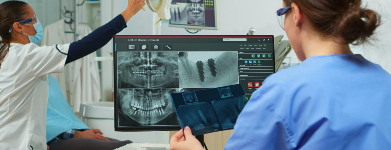 Dental Implant
