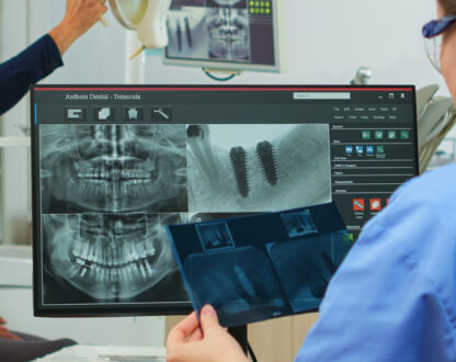 Dental Implant