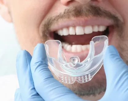 Why-Dentists-Recommend-Custom-Night-Guards-for-Bruxism-Relief